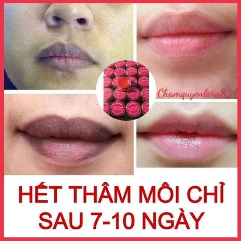 Tẩy thâm môi colagel Thiên Di, môi hết thâm,hồng hào, mềm mại