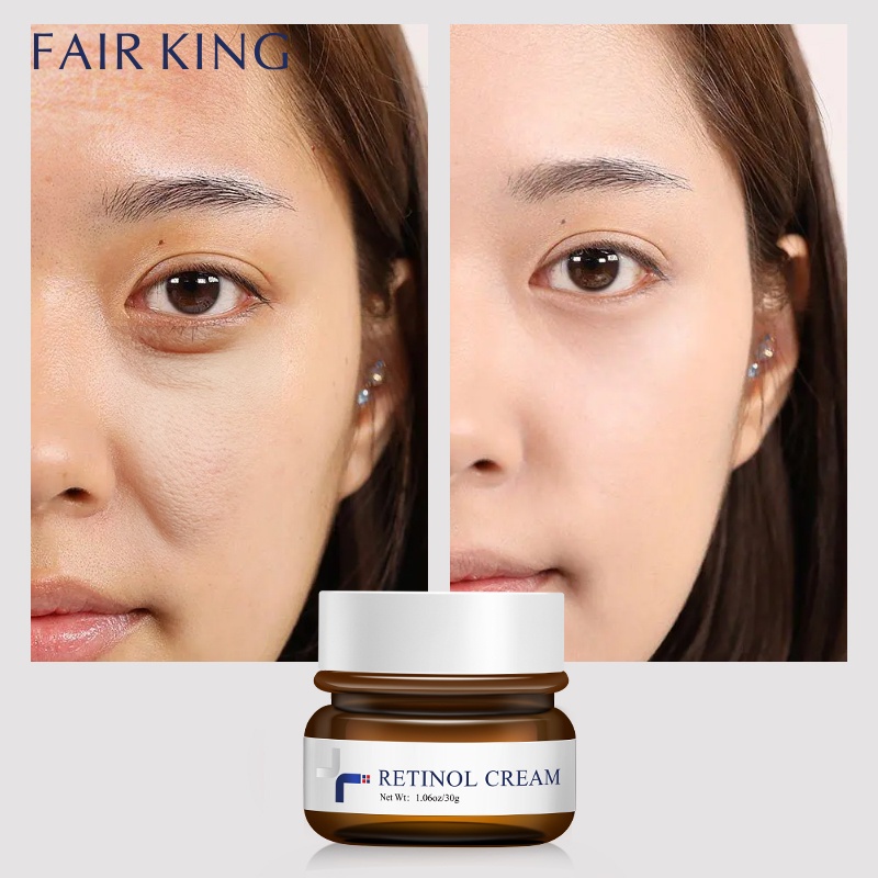 Kem dưỡng da mặt FAIR KING chứa Retinol tự nhiên chống lão hóa làm săn chắc da 30g