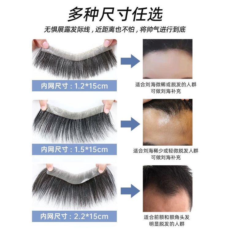 Tóc Giả Vô Hình Không Đường May Dán Tóc Mái Ngang Trán Cho Nam