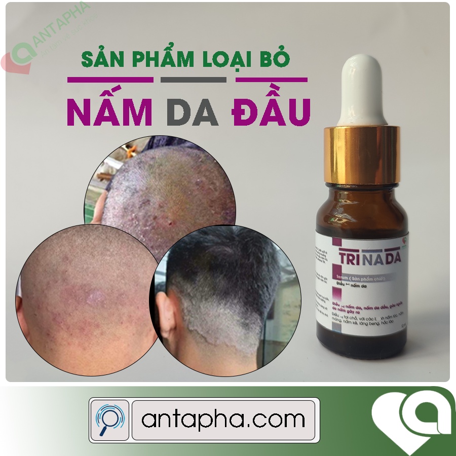 Serum Loại bỏ nấm da đầu TRINADA dạng triết 10 ml dành cho người bị nấm da đầu lâu lăm
