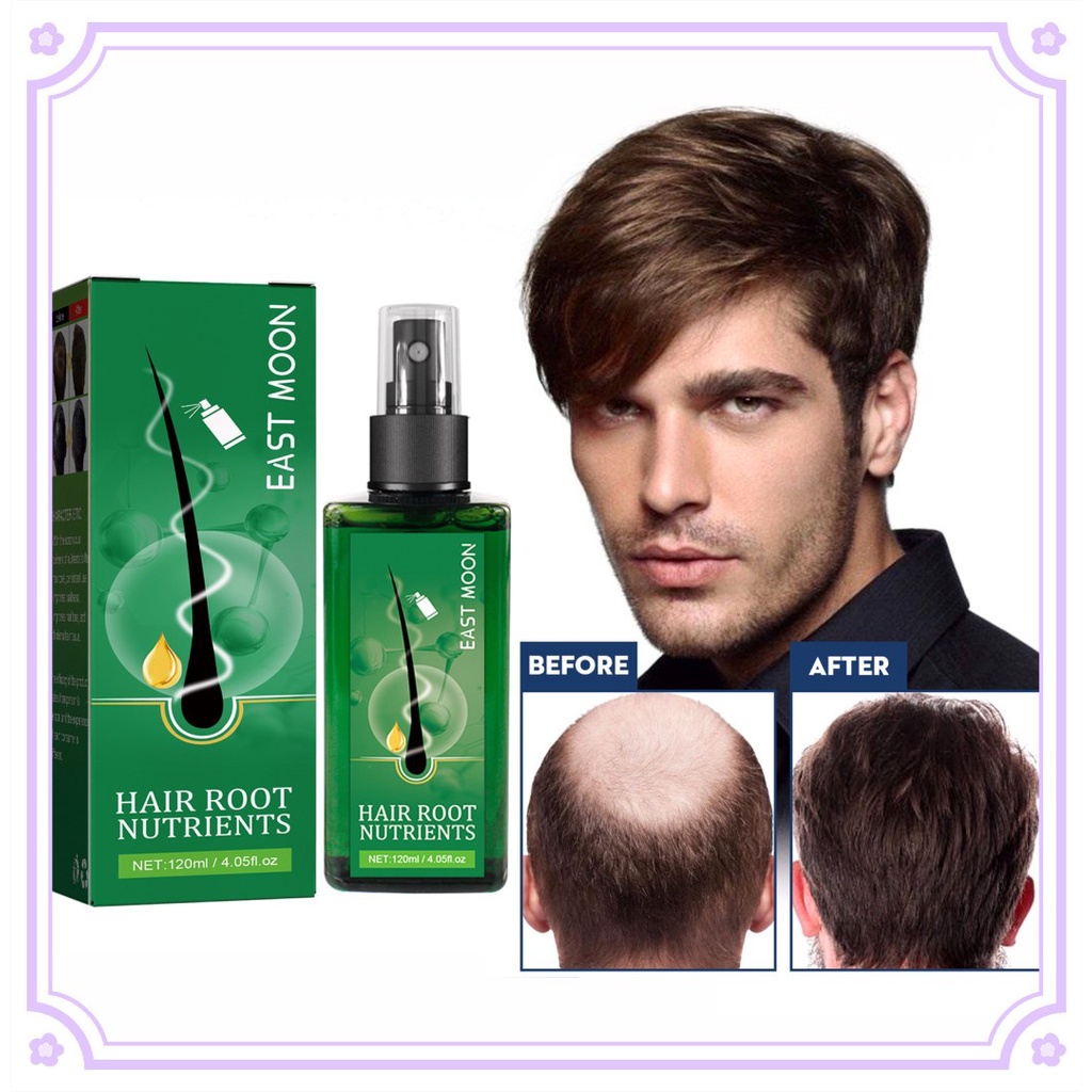 Đông Moon 120Ml Chống Rụng Tóc Mọc Tóc Xịt Tinh Dầu Dưỡng Tóc Chất Lỏng Cho Nam Điều Trị Rụng Tóc cho Chải Chuốt Tăng Trưởng Chăm Sóc Tóc Produits 1 Cái
