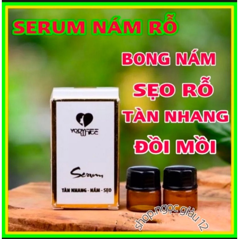MỘT CẶP BONG NÁM RỖ PHƯƠNG ANH