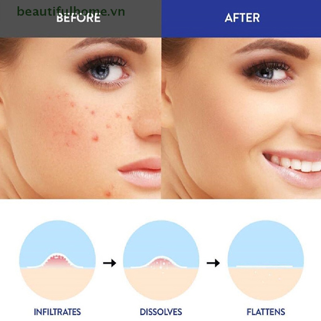 Bộ 9 Miếng Dán Microneedle Hỗ trợ giảm mụn Chăm Sóc Da Mịn Màng