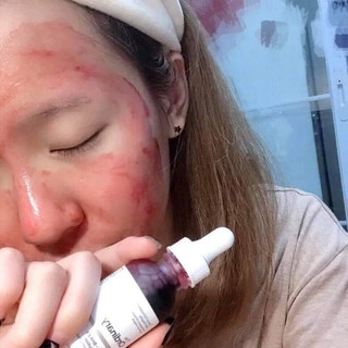 Serum the ordinary aha 30% + bha 2% peeling solution