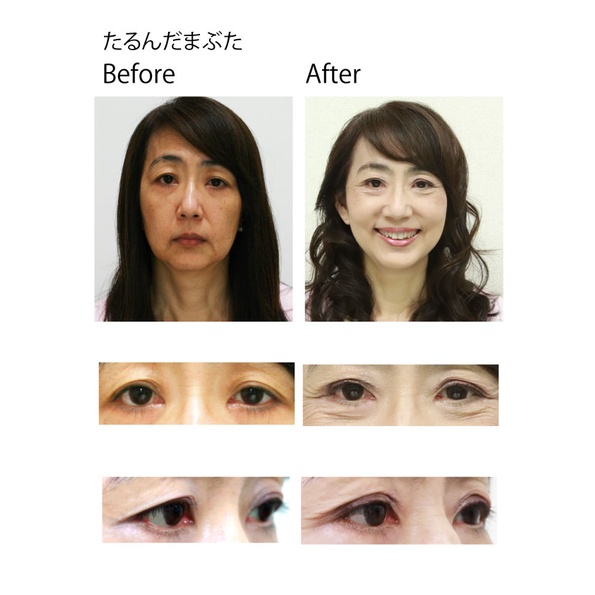 Gel kích mí AISHITOTO LeDouble Plus Nhật Bản 4ml