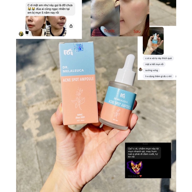 Serum mụn Acne Spot