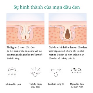 Set 3 / 8 Miếng Dán Mũi Làm Sạch Sâu Breylee