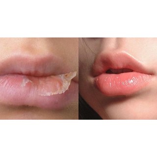 Sáp nẻ Vaseline hộp sắt