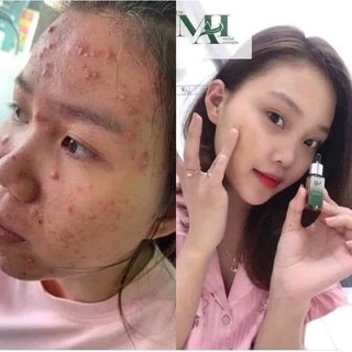 [ Chính hãng] SỮA RỬA MẶT DR MAI