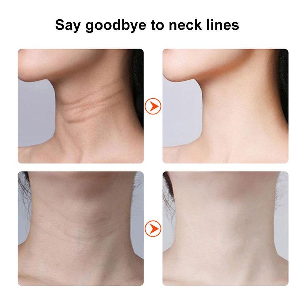 Máy Mát Xa Chăm Sóc Da Cổ Chống Nếp Nhăn Tiện Dụng