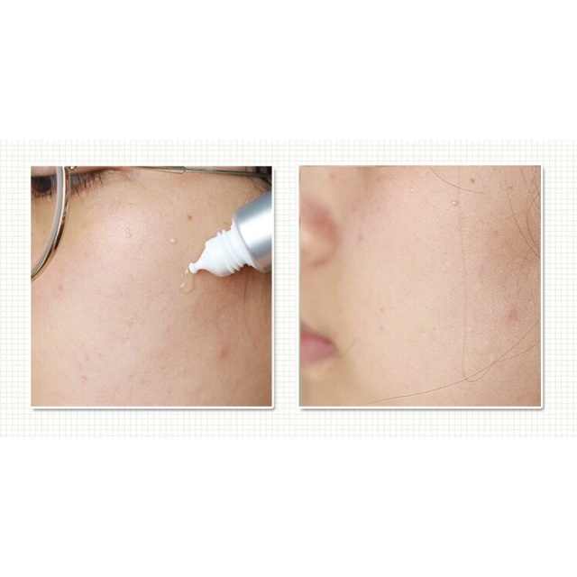 Serum dưỡng trắng da chống thâm nám Melano CC Whitening Essence 20ml