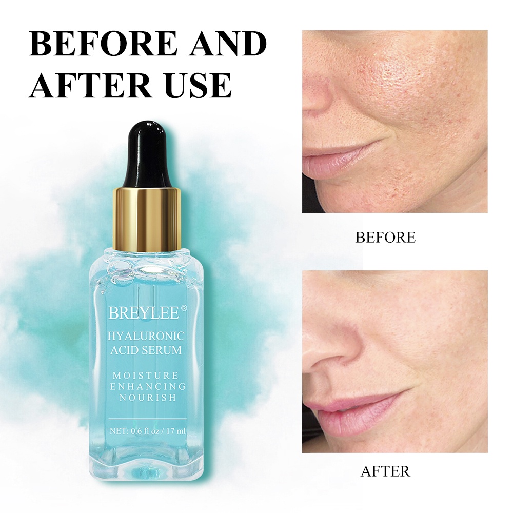 Serum Cấp Ẩm Breylee Hyaluronic Acid Giảm Nếp Nhăn Phục Hồi Da Cho Mọi Loại Da