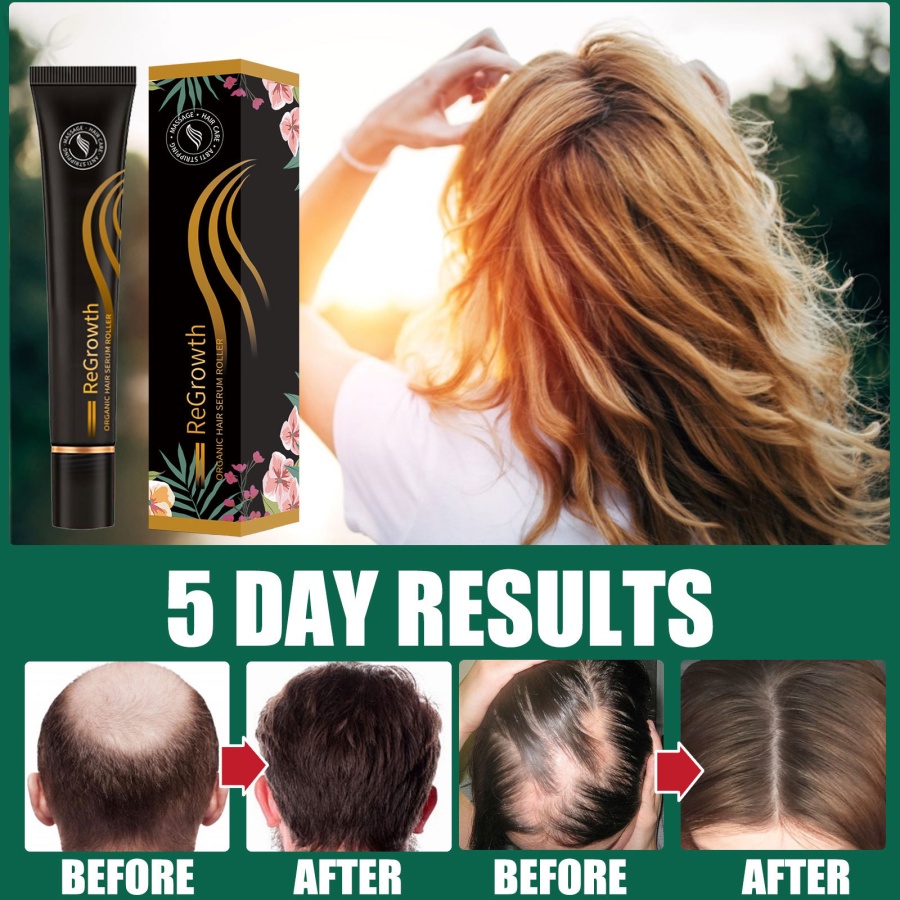 Jmmz Bộ Dụng Cụ Lăn Mát Xa Tóc Cải Thiện Tình Trạng Rụng Tóc Hữu Cơ Chống Rụng Tóc Hữu Cơ