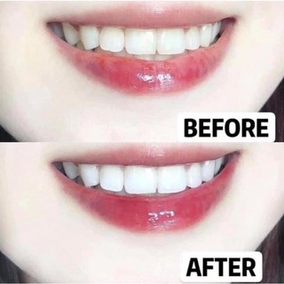 Combo kem đánh răng và bột làm trắng răng Eucryl