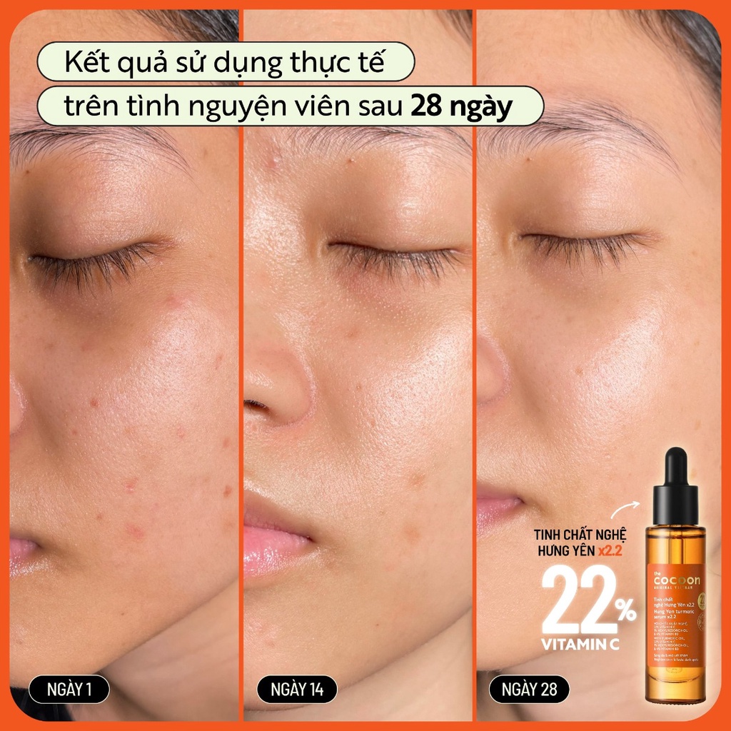 Tinh chất nghệ Hưng Yên x2.2 (serum) với 22% vitamin C sáng da chuyên sâu & mờ vết thâm Thuần chay 30ml