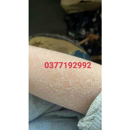 BoDy Bong da - tái sinh làn da