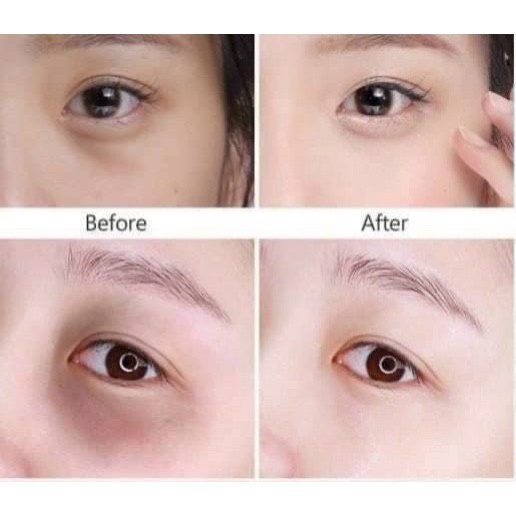 SERUM Giảm Thâm Mắt, Dưỡng Hồng Môi giảm thâm mắt, dưỡng mắt quầng thâm mắt
