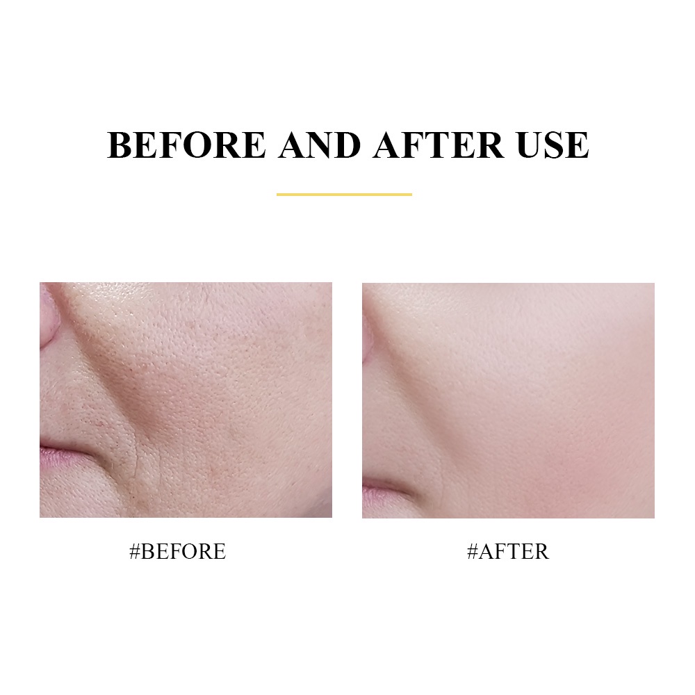 Mặt Nạ Breylee Retinol Chống Lão Hóa Chống Nhăn Làm Trắng Da Săn Chắc 25ml