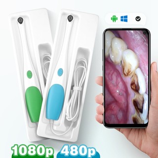 Camera nội soi răng 500hd pixel android 3 trong 1 1080p chống thấm nước