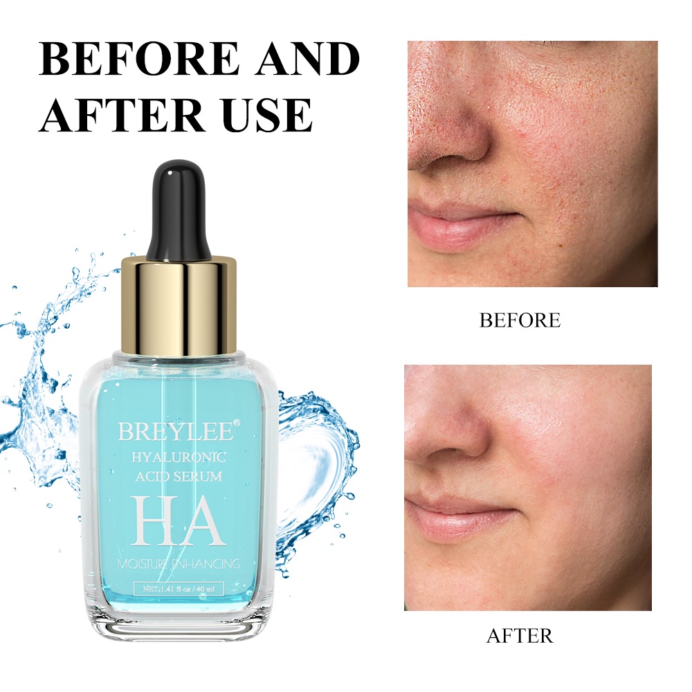 Tinh Chất Serum Axit Hyaluronic BREYLEE 40ml Dưỡng Ấm Ngậm Nước Chống Lão Hóa Da