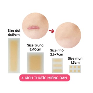 Miếng dán che khuyết điểm che sẹo lồi sẹo lõm sẹo thâm tiệp màu da Nhật Bản 4 kích thước A1001