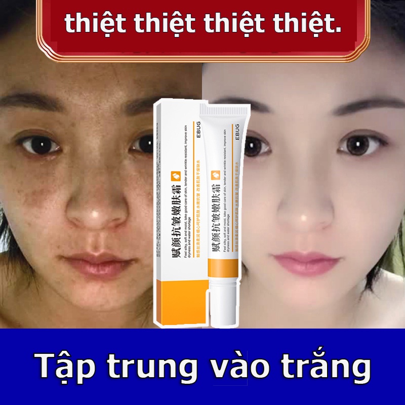 Kem retinol dưỡng da mặt vovigo JMMZ làm trắng dưỡng ẩm kiềm dầu thu nhỏ lỗ chân lông chống lão hóa và nếp nhăn 20