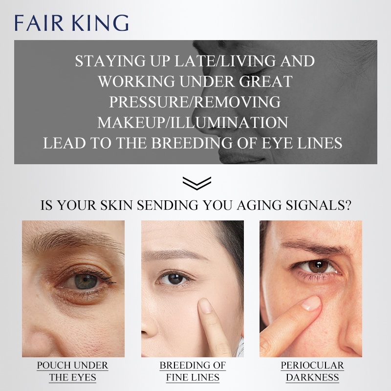 Kem Dưỡng Da Mắt FAIR KING Retinol Chống Lão Hóa Xóa Mờ Nếp Nhăn Dưỡng Ẩm Làm Trắng Giảm Quầng Thâm 15g