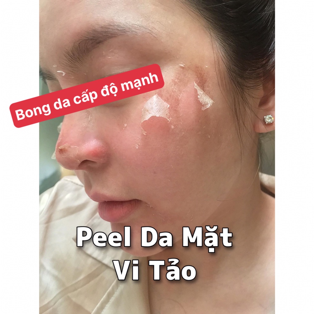 Peel da mặt vi tảo biển BTox - tẩy da chết thay da sinh học cho mặt - Pell lột da mặt - tái tạo da mờ thâm nám