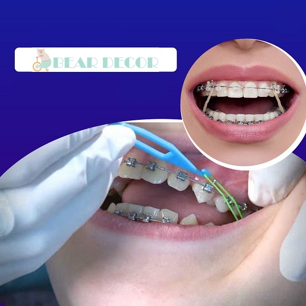 Thun Liên Hàm, Chun Chỉnh Nha, Niềng Răng Gói 100 Cái