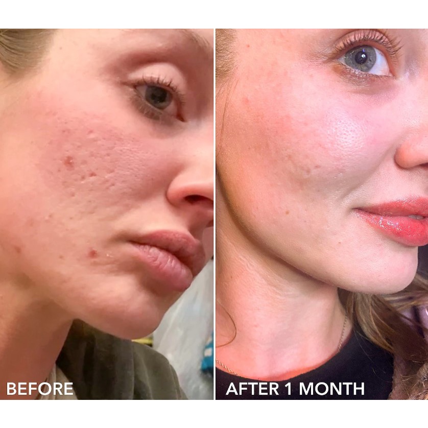 Sample 2 gói - Tẩy da chết Dr Dennis Gross Alpha Beta® Daily Peel 2 bước