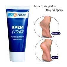 Kem dưỡng da gót chân hiệu quả