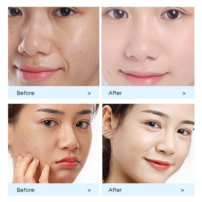 Mặt Nạ Dưỡng Ẩm Collagen Hàn Quốc Mặt Nạ Dưỡng Ẩm Da Khô Bổ Sung Collagen Ngăn Ngừa Lão Hóa Giúp Da Căng Bóng Mịn Màng