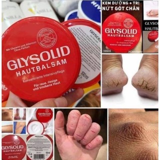 Kem dưỡng da khô nứt Glysolid (có bill Đức)