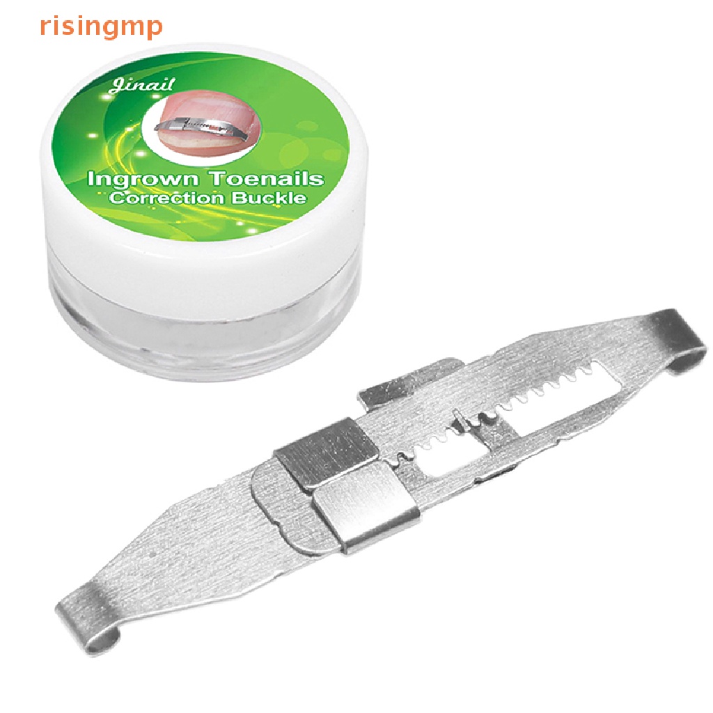 1 Dụng Cụ Chỉnh Sửa Móng Chân Mọc Ngược