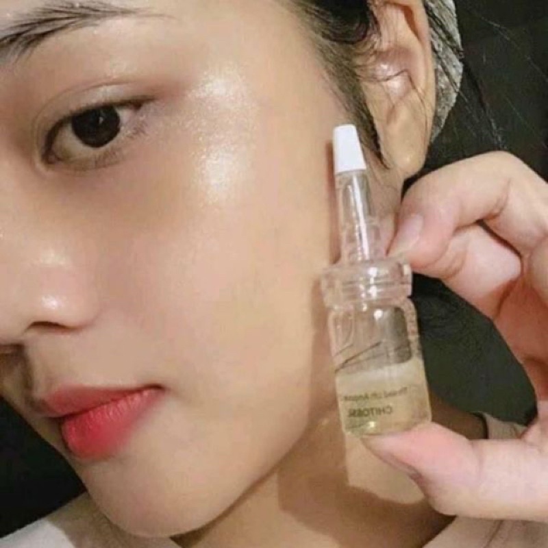 Cấy chỉ tơ tằm - Chỉ tơ tằm chitossil