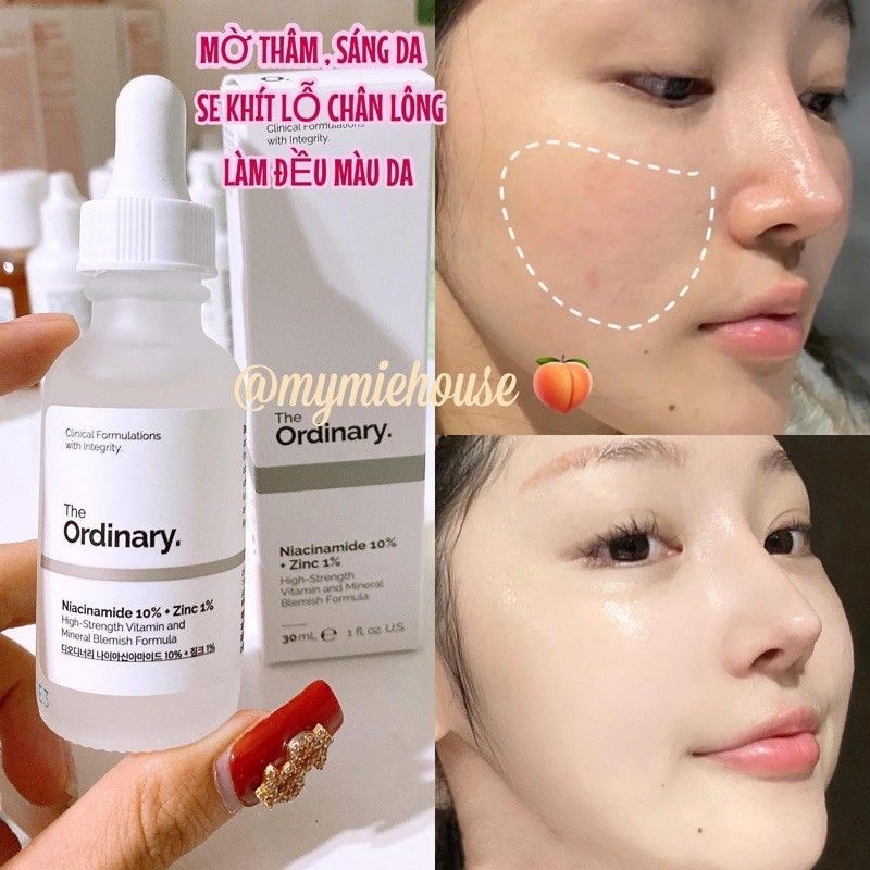 Serum Niacinamide 10% + Zinc 1% The Ordinary dưỡng trắng da số 1 thế giới