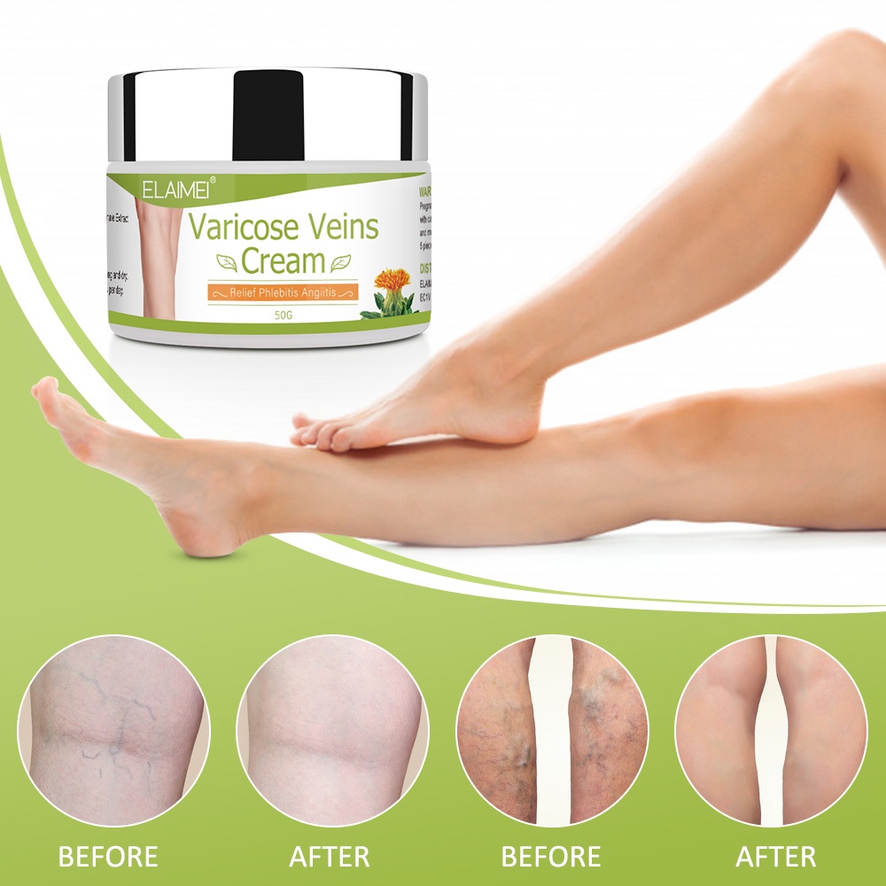 Kem bôi giãn tĩnh mạch JULYSTAR 50g dưỡng chân dễ thoa