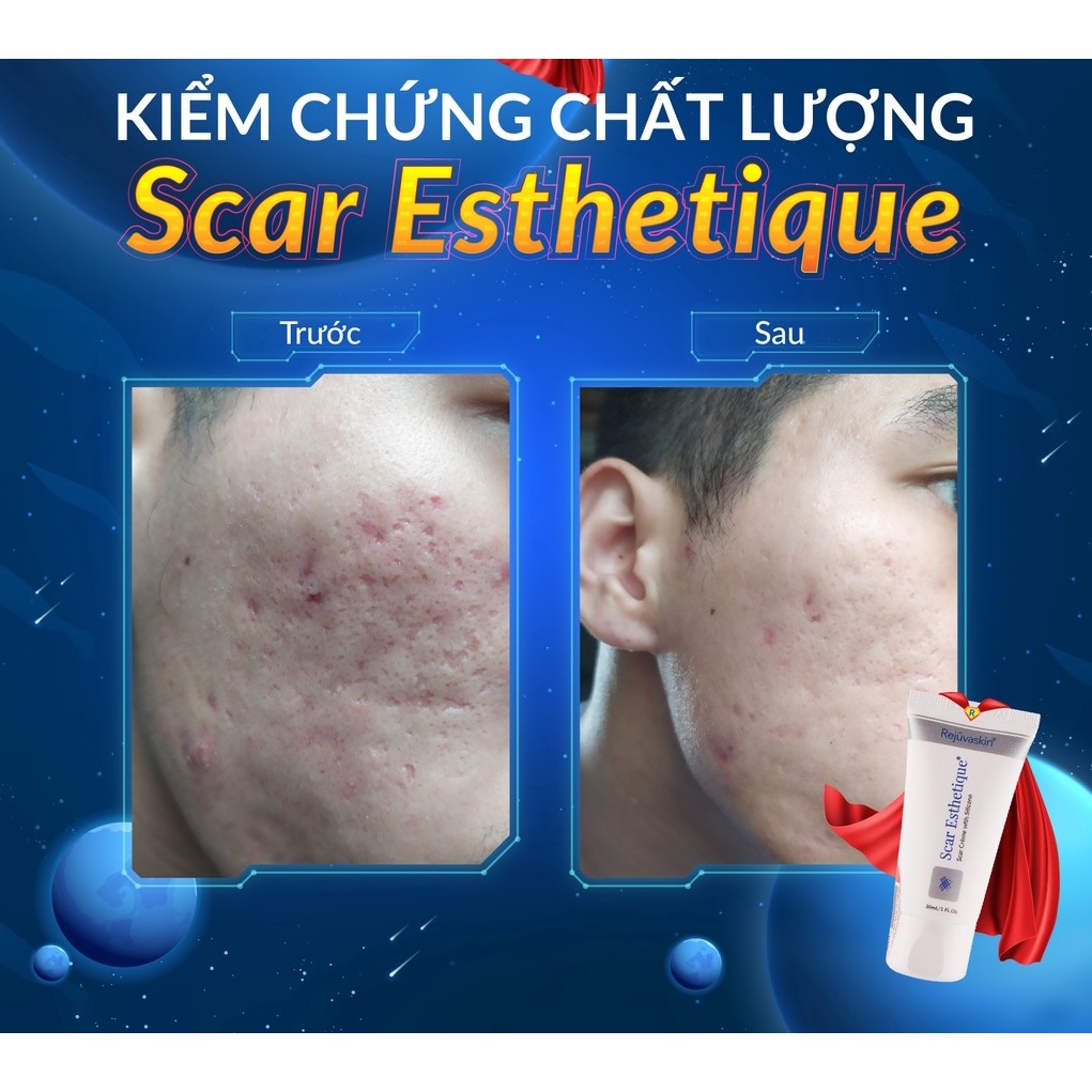 Kem Xóa Sẹo Thâm / Rỗ / Lõm Scar Esthetique Rejuvaskin 60ml - Scar Esthetique 60ml