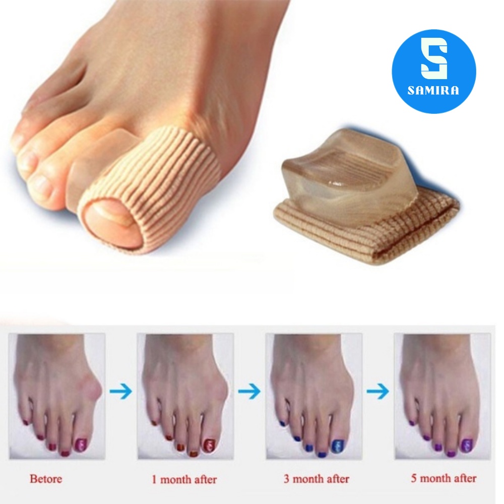 2 Dụng cụ silicon tách thẳng ngón chân cái ngón chân bị vẹo nhỏ gọn SA25