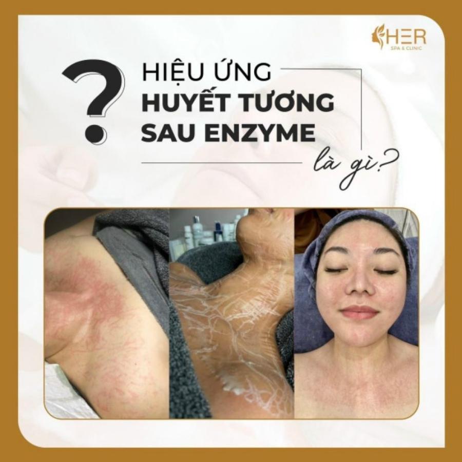 Bộ Enzyme therapy tái tạo da DMK