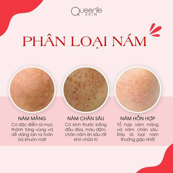 Kem Huyết Nám Bóc Tách X2