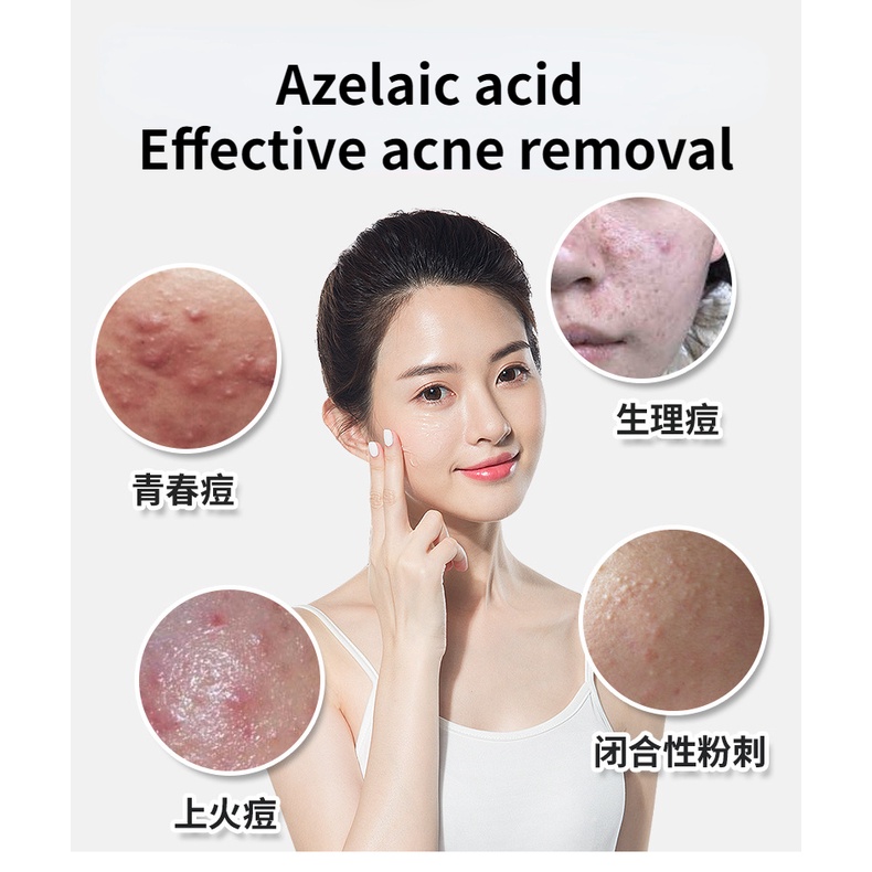 Gel Hỗ trợ giảm mụn DETVFO 20g Làm Sạch Sâu Lỗ Chân Lông Kiểm Soát Dầu Và Làm Sáng Da