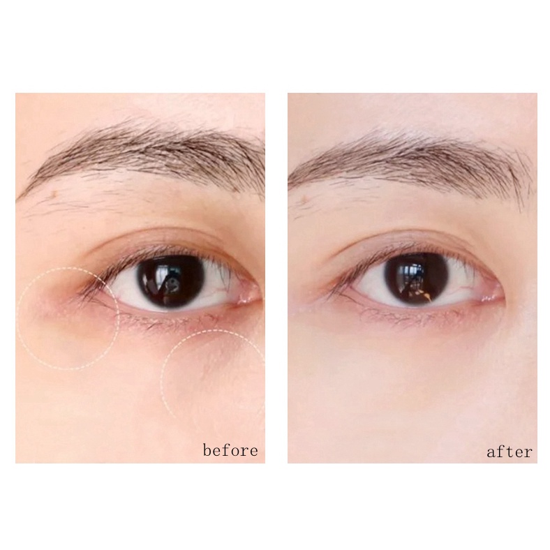 Estee Lauder Tinh Chất Mắt Advanced Night Repair Eye Concentrate Matrix 15ml