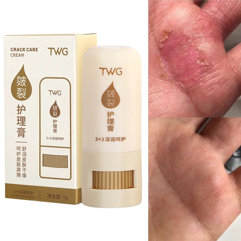 1 Tuýp Kem Dưỡng Ẩm Tẩy Da Chết Chống Khô Nứt Nẻ Gót Chân Và Tay Hiệu Quả