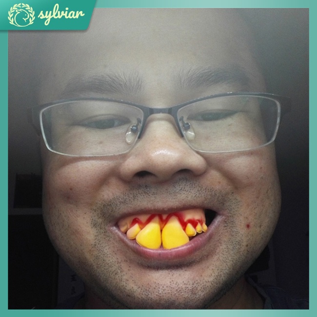 Hàm Răng Giả Mềm Hóa Trang Halloween Vui Nhộn