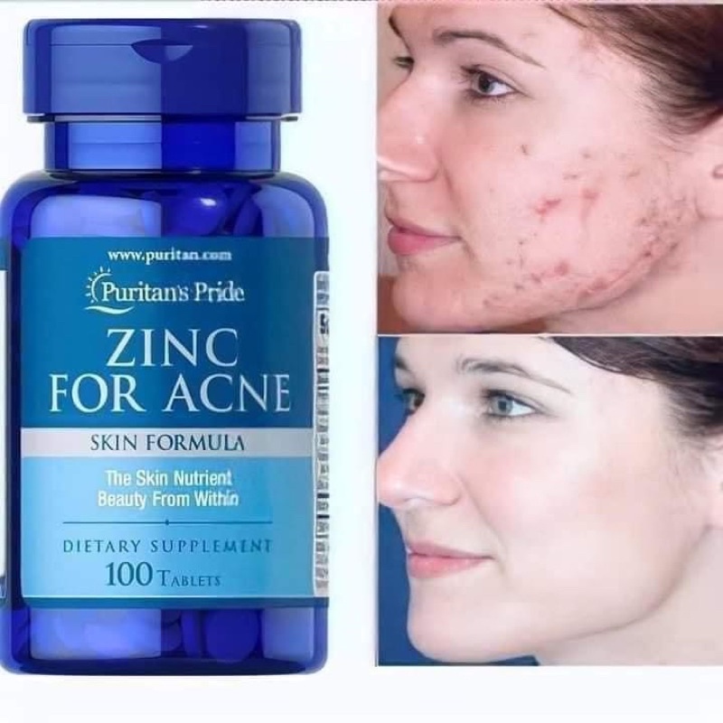 Viên uống kẽm ngừa mụn trứng cá Puritan’s Pride Zinc For Acne 100 Tablets