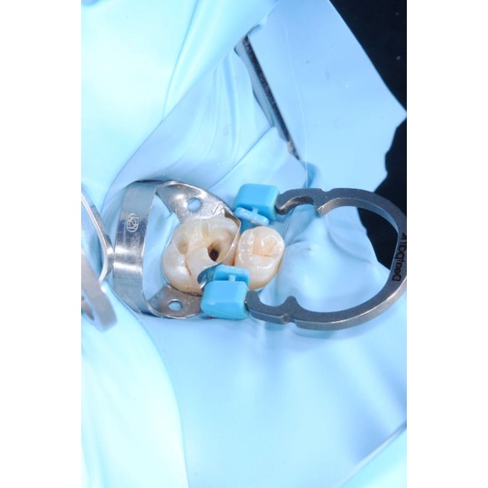 ĐÊ CAO SU NHA KHOA