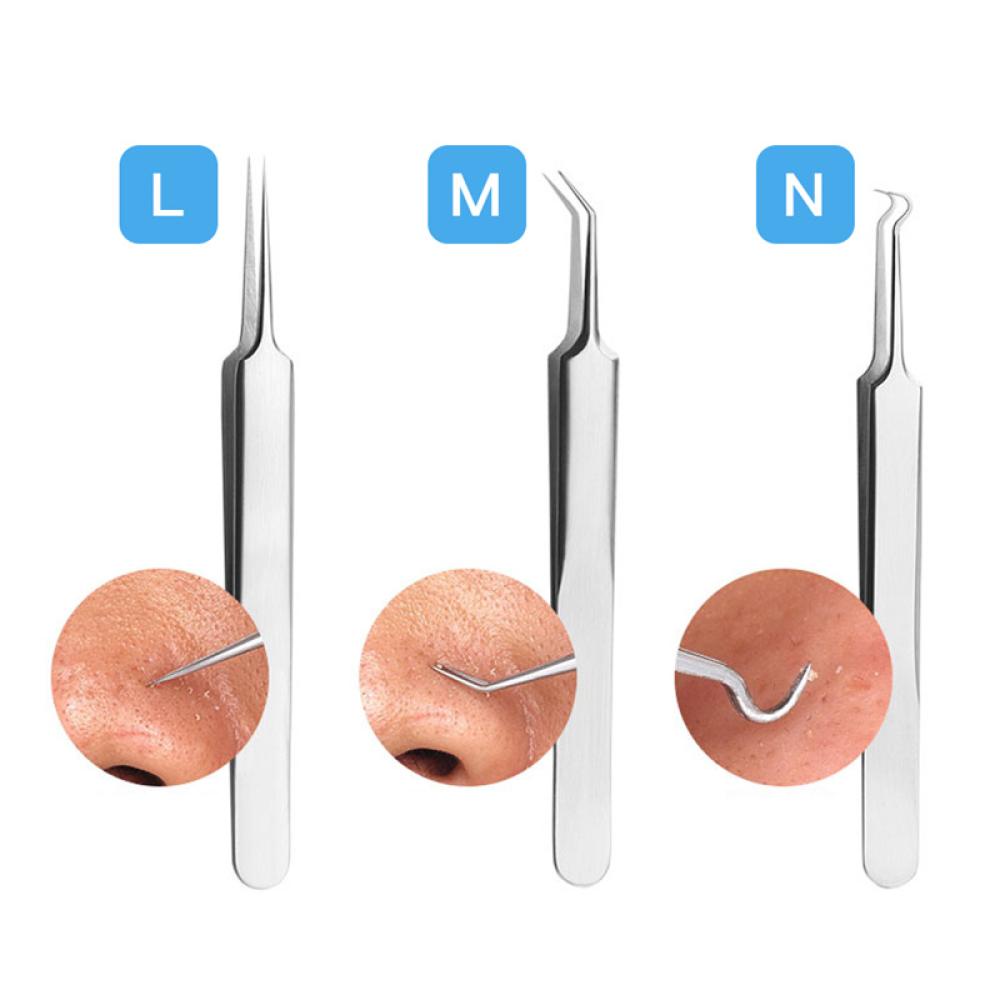 Kim Inox Hỗ Trợ Giảm Mụn Đầu Đen Làm Sạch Da H2O3