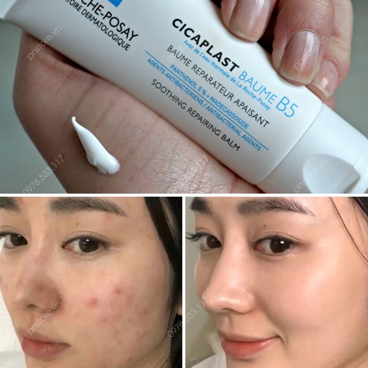 Kem Posay B5 phục hồi, làm dịu da khô, da kích ứng – QT772