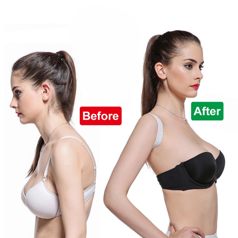 Đai Chỉnh Tư Thế Chống Gù Lưng Cho Nam Và Nữ